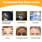 Forehead Wrinkle Patches Face Wrinkle Patches (10 Pcs Set) thumbnail 1